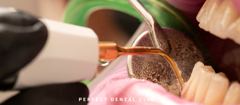 치주염, 치은염 치료와 예방법 관련 이미지 2