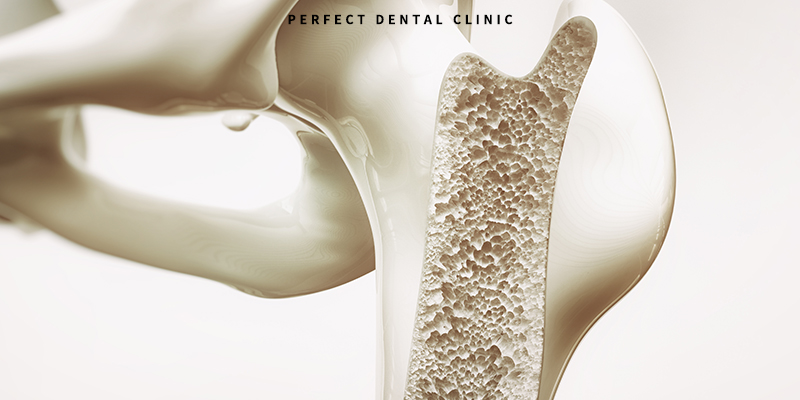 골다공증환자 치과치료 주의사항 관련 이미지 2