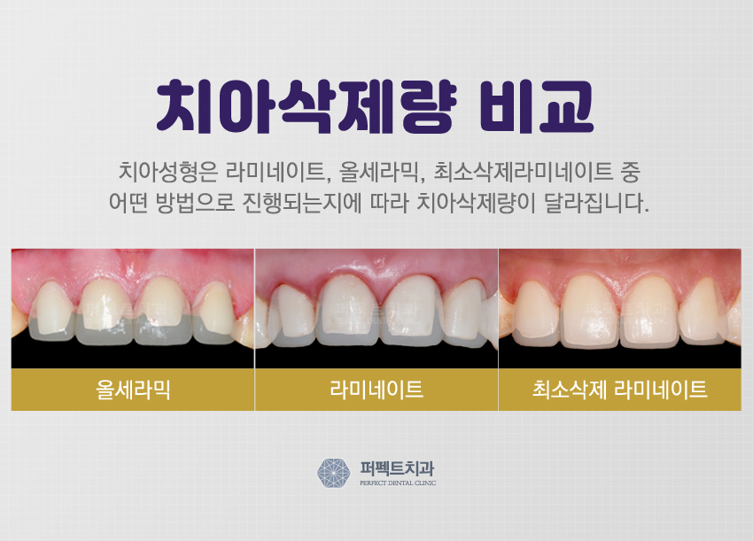 강남 최소삭제라미네이트 알아주는 치과 관련 이미지 4