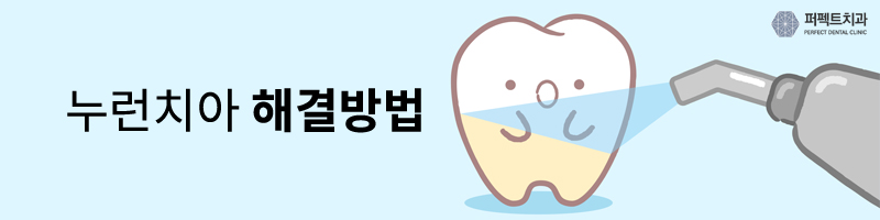 누런치아, 원인과 해결방법! 관련 이미지 3