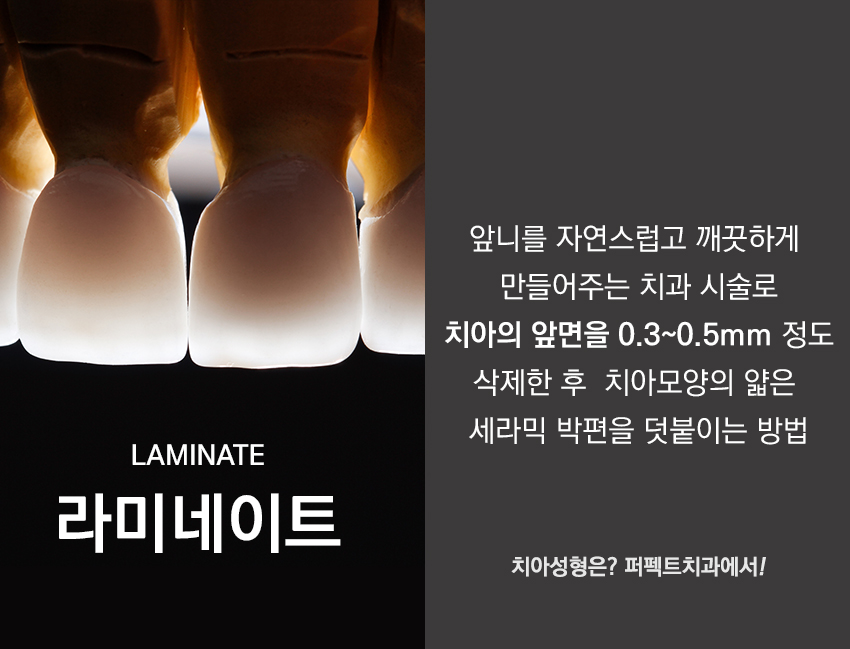 강남라미네이트 바로알기 관련 이미지 1