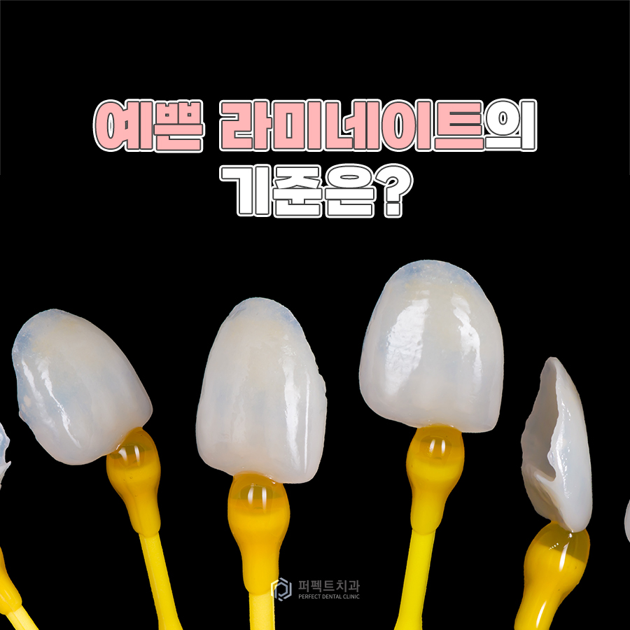 예쁜 라미네이트의 기준이 있나요? 관련 이미지 1