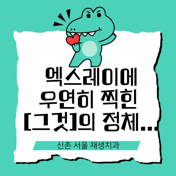 [재신경치료] 엑스레이를 찍었더니 치아 뿌리 염증이 보인대요! (현미경 신경치료, 서울재생치과) 관련 이미지 1