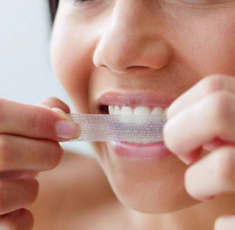 치아미백에 관한 거의 모든 것 (자주 묻는 질문, 시술 방법, 주의사항, 임산부, 수유부, 이시림, 피해야할 음식) 관련 이미지 4