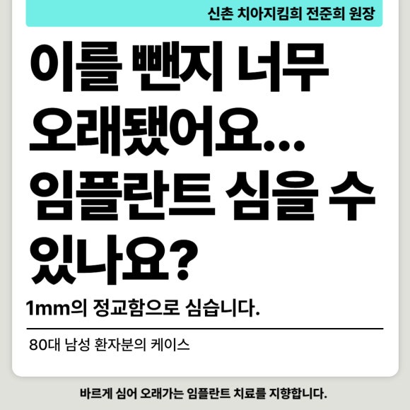 [임플란트] 이가 빠진지 오래되서 옆 치아들이 쓰러졌어요. 임플란트 가능할까요? 네, 가능합니다.1mm의 정교함으로! 관련 이미지 1