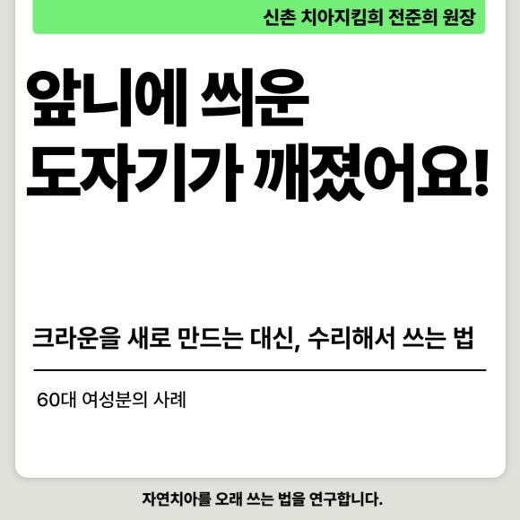 [앞니치료] 앞니에 씌운 도자기가 깨졌을 때, 새로 만드는 대신 수리해서 쓰는 법 (도자기파절, 레진치료) 관련 이미지 1
