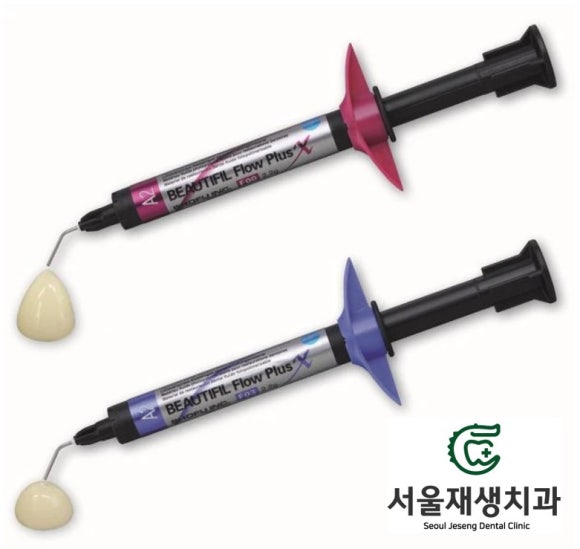 이갈이, 이악물기로 치아가 깨졌어요. 어떻게 치료하나요? (크라운치료 장단점, 레진치료 장단점, 신촌치과,서울재생치과,치아파절,어금니치료) 관련 이미지 5