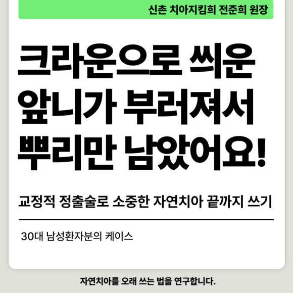 [치아살리기] 크라운 씌운 치아가 부러졌어요. 교정적정출술을 통해 내 치아 끝까지 써보기 관련 이미지 1