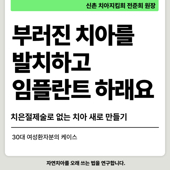 [치아살리기] 부러진 치아를 빼고 임플란트해야 한대요. 관련 이미지 1