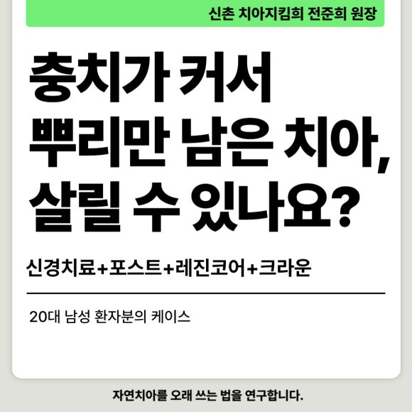 [신경치료] 충치가 커서 뿌리만 남았대요. 비발치 신경치료로 자연치아 살리기! 관련 이미지 1