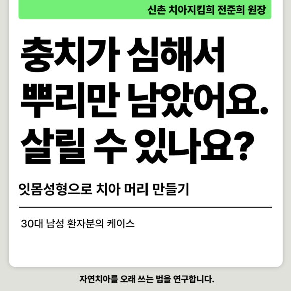 [치아살리기] 뿌리만 남은 치아의 치료 관련 이미지 1
