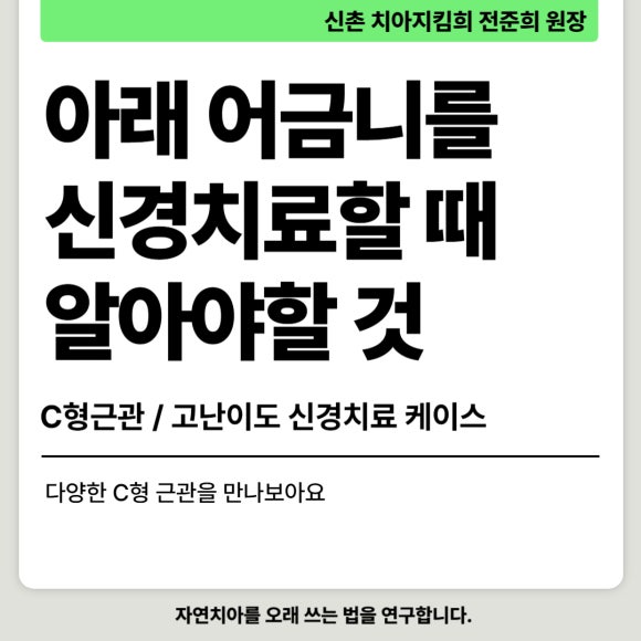 [신경치료] 아래 어금니를 신경치료 할 때 치료할 때 알아야 할 것 (C형근관,고난이도치료) 관련 이미지 1