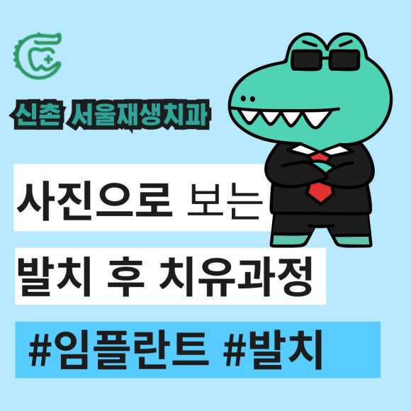 [발치 후 치유과정] 이를 뺀 후 아무는 과정, 단계별 주의사항 (신촌 서울재생치과) 관련 이미지 1
