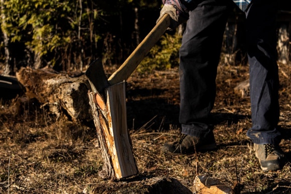 잇몸 패임, 무슨 재료로 때우나요? 레진과 글라스아이오노머(GI)로 치경부마모증 치료하기 (서울재생치과,신촌치과) 관련 이미지 6