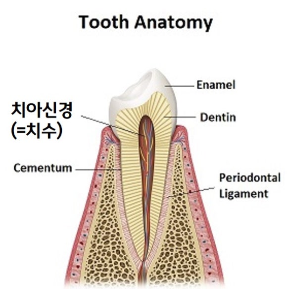 치아가 변색되면 무조건 크라운을 해야 하나요? (치아 미백, 실활치 미백, 신경치료 후 미백, 신촌치과추천,서울재생치과) 관련 이미지 2
