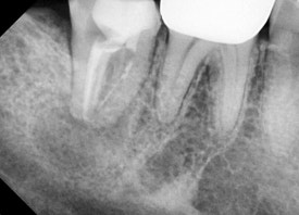 전준희 대표원장 소개 & 서울재생치과의 진료철학 관련 이미지 2
