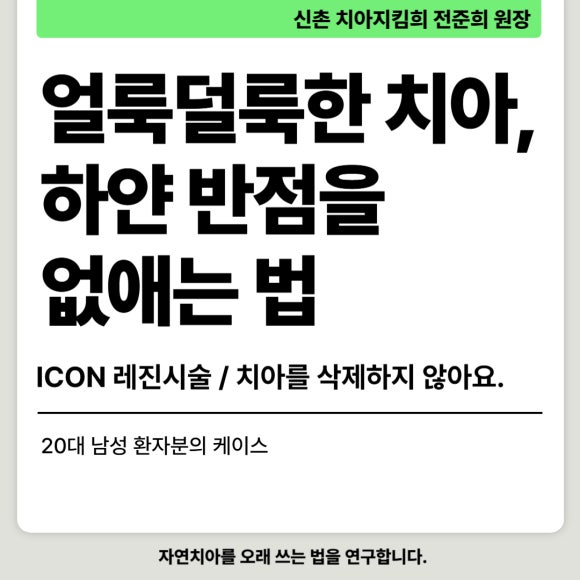 얼룩덜룩한 흰반점, white spot을 치료하는 법 (무삭제 충치치료) 관련 이미지 1