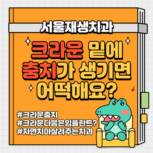크라운 다음은 임플란트인가요...? (크라운 밑으로 생긴 충치, 크라운 다음엔 어떤 치료를...?, 자연치아 살리는 치과, 서울재생치과) 관련 이미지 1
