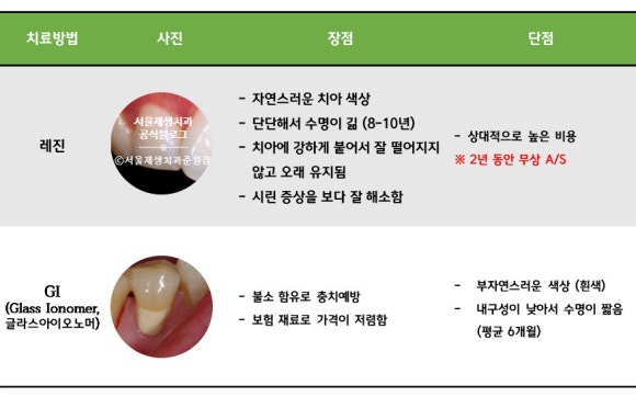 잇몸 패임, 무슨 재료로 때우나요? 레진과 글라스아이오노머(GI)로 치경부마모증 치료하기 (서울재생치과,신촌치과) 관련 이미지 11