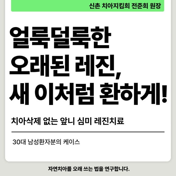 [앞니재치료] 얼룩덜룩한 오래된 레진, 새 이처럼 환하게 재치료하기 관련 이미지 1