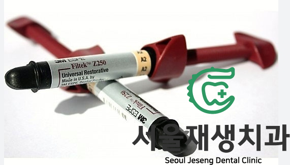 [치료사례] 잇몸 패임 때문에 음식이 많이끼고 충치가 생겨요. 관련 이미지 4