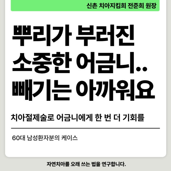 [치아절제술/hemisection] 뿌리가 부러진 소중한 내 어금니..이대로 뽑긴 아까워요. 관련 이미지 1