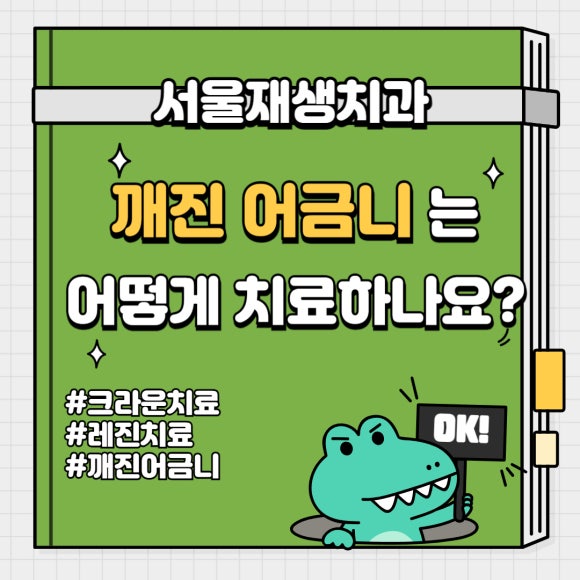 이갈이, 이악물기로 치아가 깨졌어요. 어떻게 치료하나요? (크라운치료 장단점, 레진치료 장단점, 신촌치과,서울재생치과,치아파절,어금니치료) 관련 이미지 1