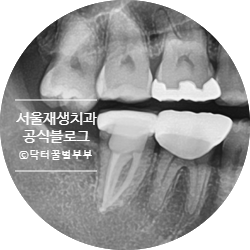 [재신경치료] 치아 뿌리 끝 염증이 너무 심하대요...발치만이 답일까요? 관련 이미지 17