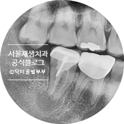 [재신경치료] 치아 뿌리 끝 염증이 너무 심하대요...발치만이 답일까요? 관련 이미지 16