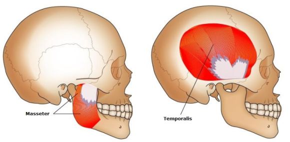 [턱관절] 임플란트 맞은 편 치아가 아파요! (외상성교합, 강한 교합력, 보톡스 치료,턱관절물리치료, 치과 보험진료) 관련 이미지 6