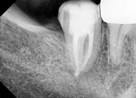 전준희 대표원장 소개 & 서울재생치과의 진료철학 관련 이미지 3