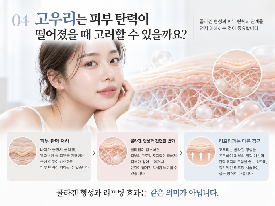 고우리 스킨부스터, 리쥬란·쥬베룩과 무엇이 다를까요? 액상 PCL과 콜라겐의 관계 관련 이미지 6