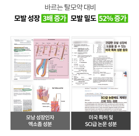 메이퓨어 동대문점 더 이상 모발 걱정은 그만!<필독> 관련 이미지 6