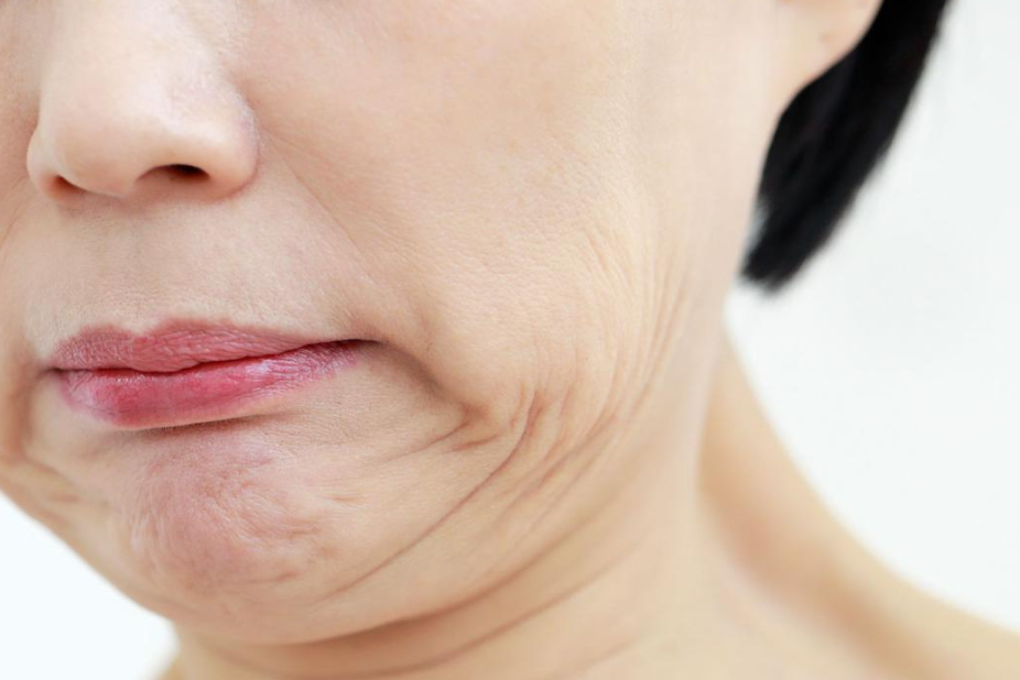 지방분해주사 동대문 완벽한 얼굴 라인을 위한 비결-컷슬린 인젝션 관련 이미지 3