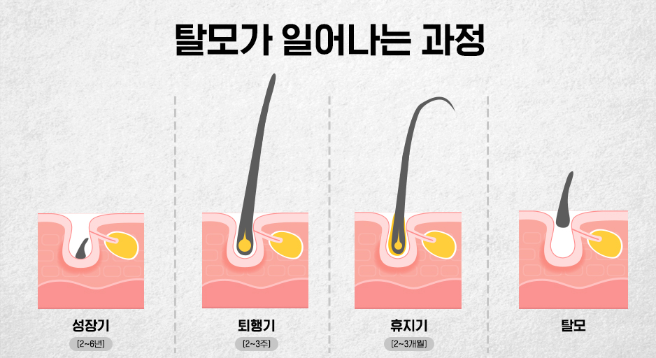 메이퓨어 동대문점 더 이상 모발 걱정은 그만!<필독> 관련 이미지 2