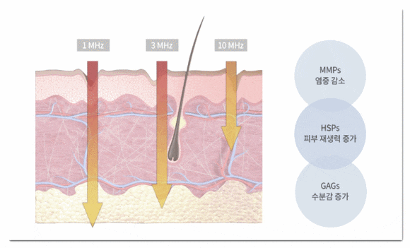 영등포LDM 푸석한 피부에 수분 공급을 관련 이미지 3