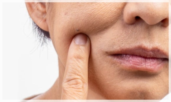 리쥬란힐러 용량 2cc, 4cc 효과 차이는? 관련 이미지 3