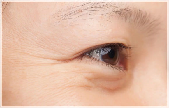 아이올리지오 효과, 눈가 탄력 잡아줄 수 있을까? 관련 이미지 2