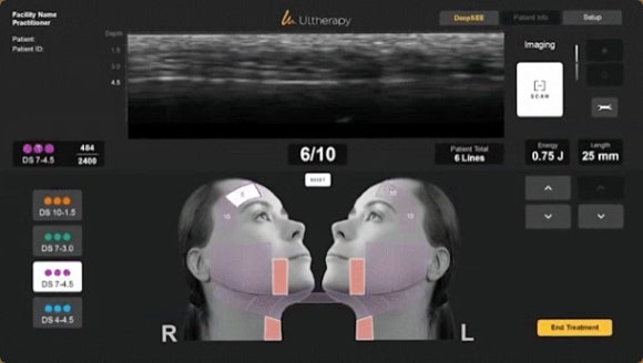 영등포울쎄라피프라임 vs 기존 울쎄라 차이 한 번에 정리해 드립니다 관련 이미지 3