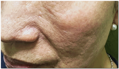 영등포슈링크 원리 뜻 정확히 알고 받으셔야 합니다 관련 이미지 4