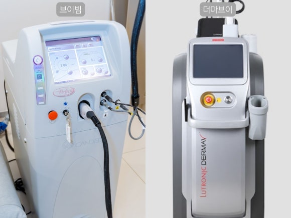 영등포 레이저토닝으로 홍조 치료한 사례 관련 이미지 3