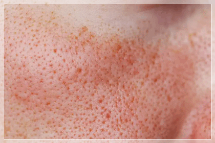 Why You Shouldn’t Choose a Popular Treatment First When Looking for a Dermatology Clinic in Dangsan image 3