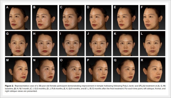 에버클 스킨부스터 효과, 어떻게 다를까? 관련 이미지 4