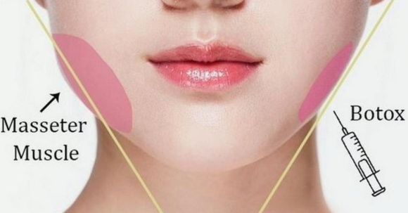 당산역보톡스, 내 사각턱에도 효과가 있을까? 관련 이미지 2