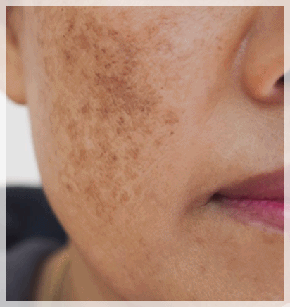 Time Square Dermatology: The Real Reason Results Differ Even with the Same Procedure image 5