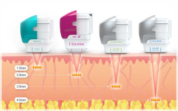 영등포역 슈링크 이렇게 받아야 효과 있습니다 관련 이미지 2