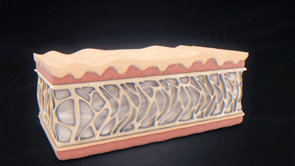 울쎄라피프라임 써마지 효과 차이 비교 관련 이미지 3