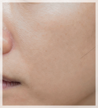 Time Square Dermatology: The Real Reason Results Differ Even with the Same Procedure image 6