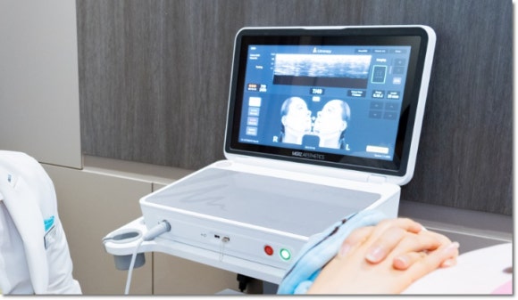 울쎄라피프라임 효과, 울쎄라랑 비교하면? 관련 이미지 6