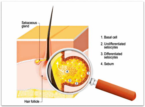 영등포 여드름 치료, 피부관리만으로 화농성 못 잡겠다면? 관련 이미지 2